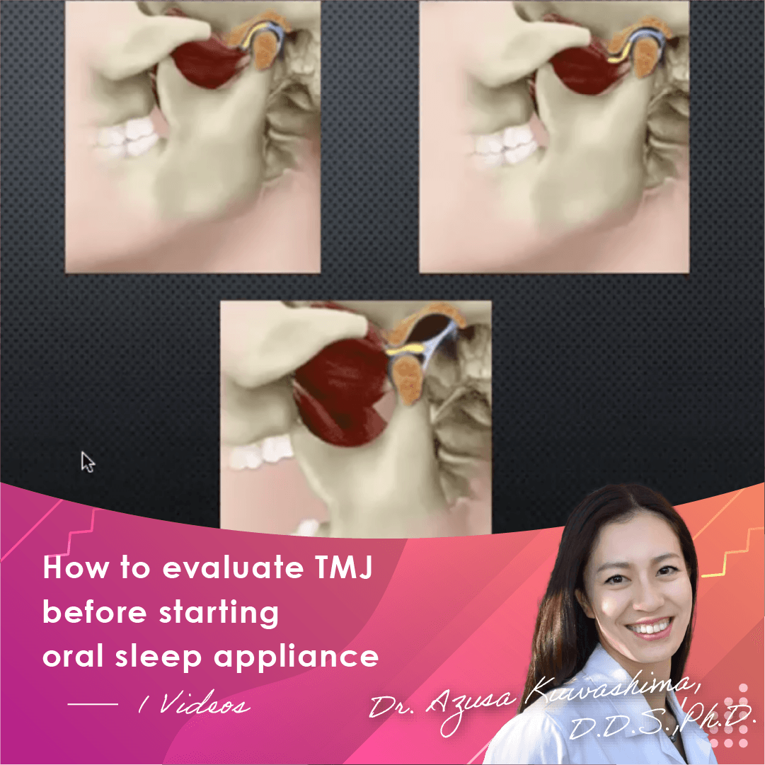 How to evaluate TMJ before starting oral sleep appliance