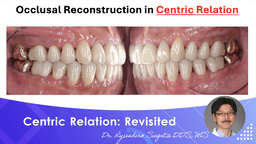 Centric Relation: Revisited