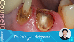 【sample】Abutment Construction