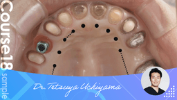 【sample】Maxillofacial Analysis 1