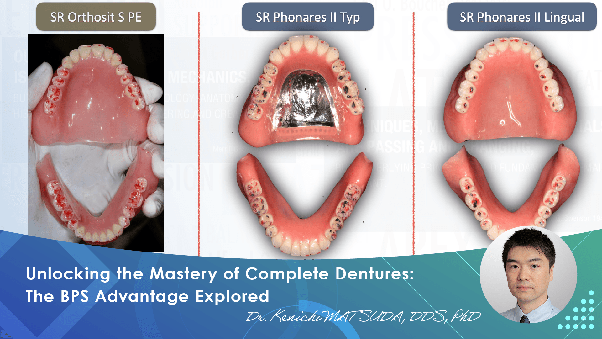 Unlocking the Mastery of Complete Dentures: The BPS Advantage Explored