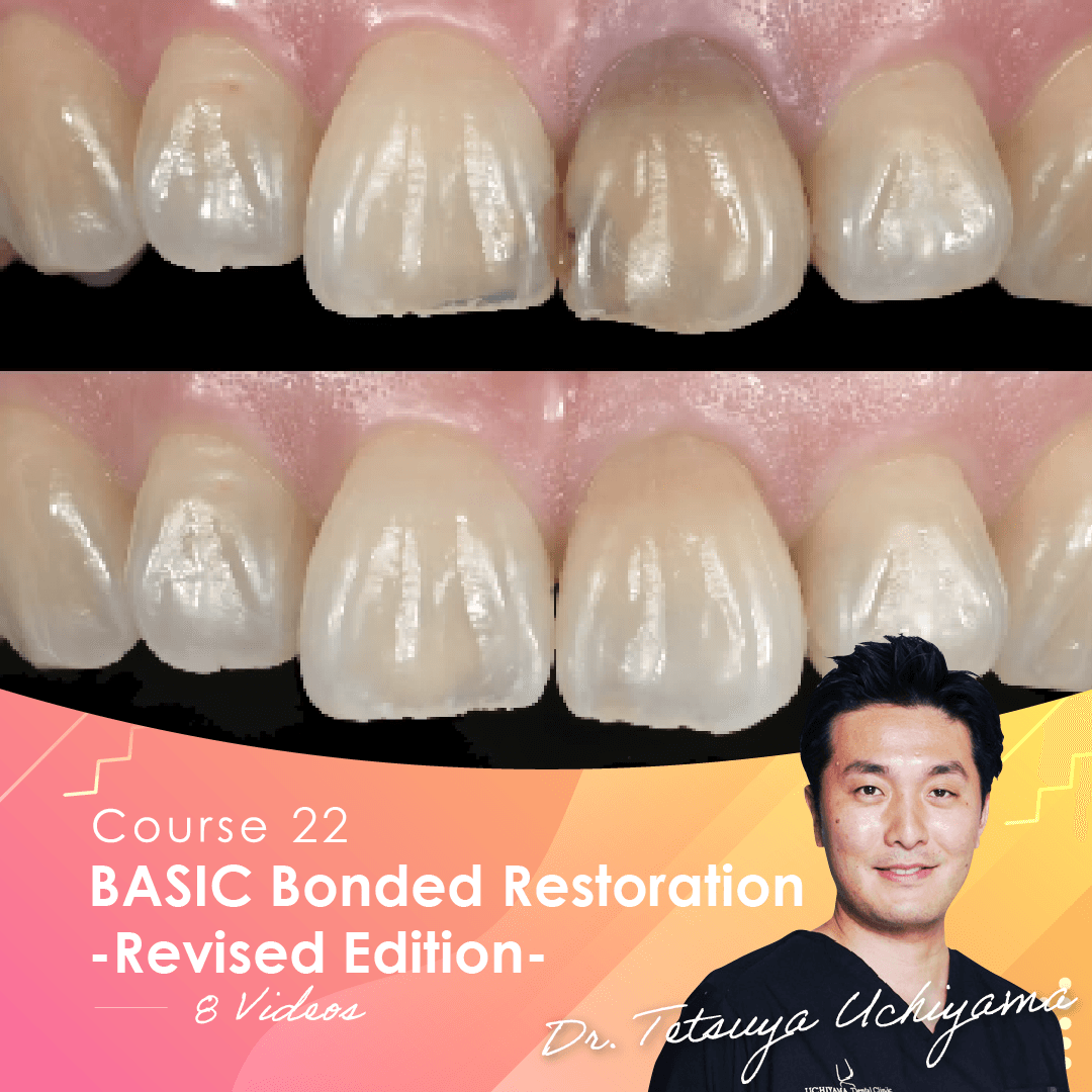 BASIC Bonded Restoration -Revised Edition-
