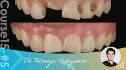 #5 Conjunction with orthodontics