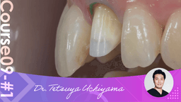 #1 Understanding the Dentogingival Complex