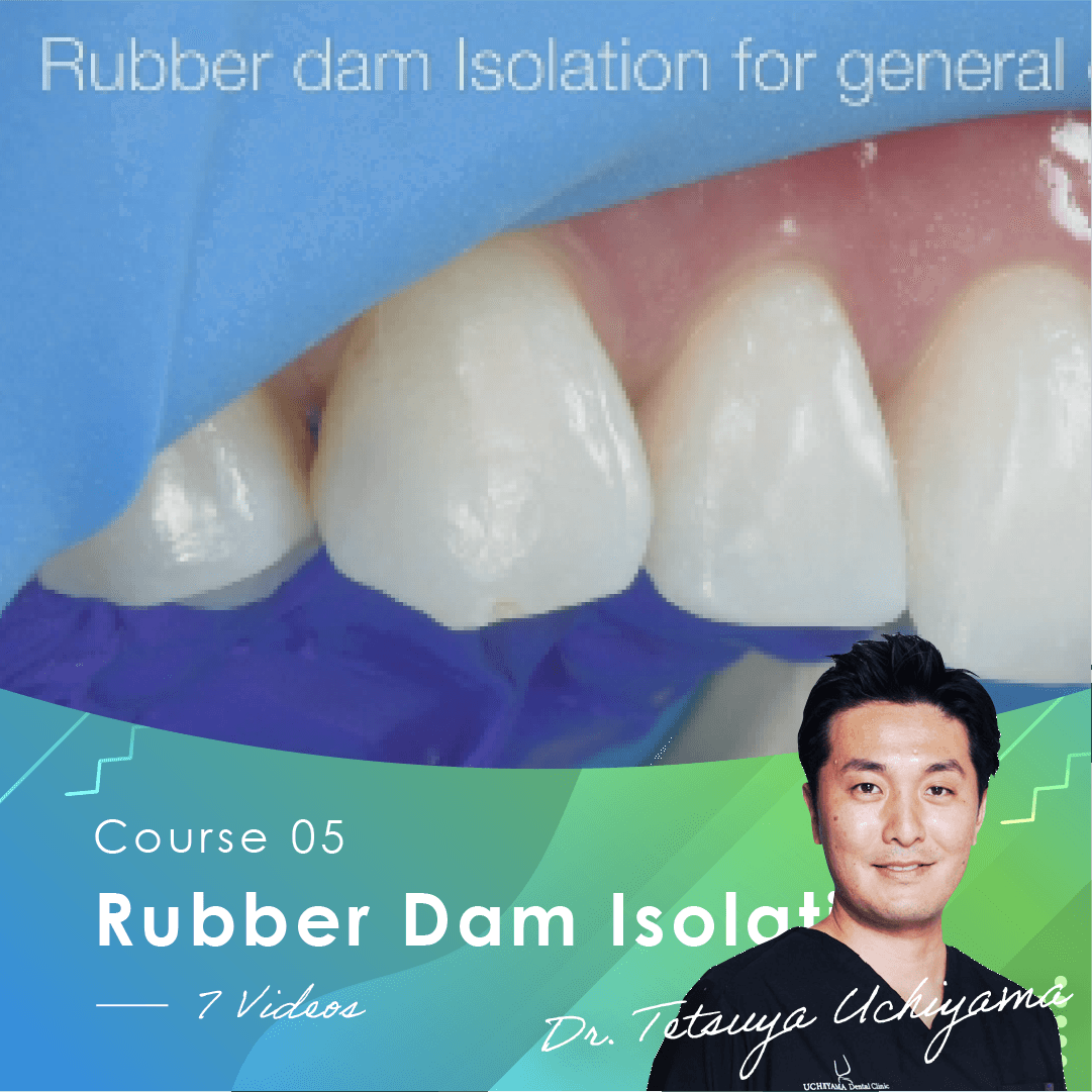 Rubber Dam Isolation